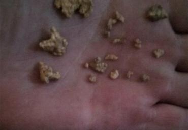 29196627_2012592619009487_2649071283404275712_n